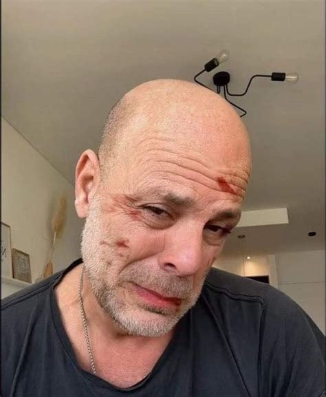 bruce willis condition today